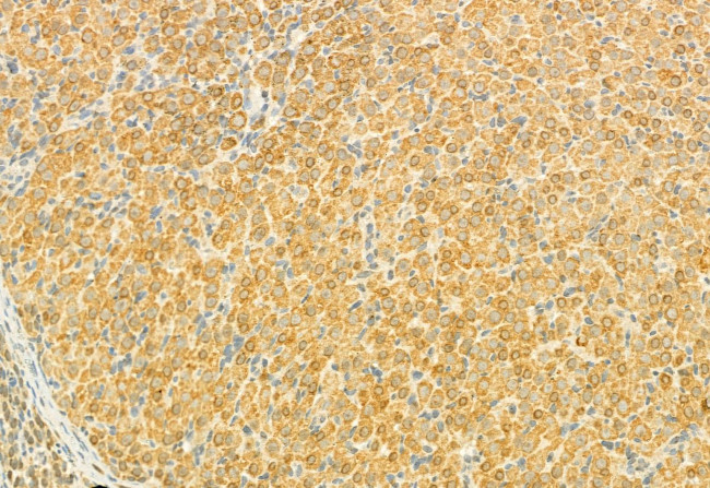 MUC2 Antibody in Immunohistochemistry (Paraffin) (IHC (P))