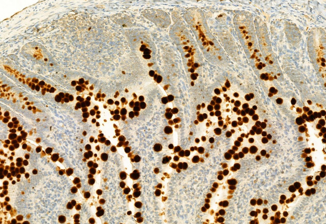 MUC2 Antibody in Immunohistochemistry (Paraffin) (IHC (P))