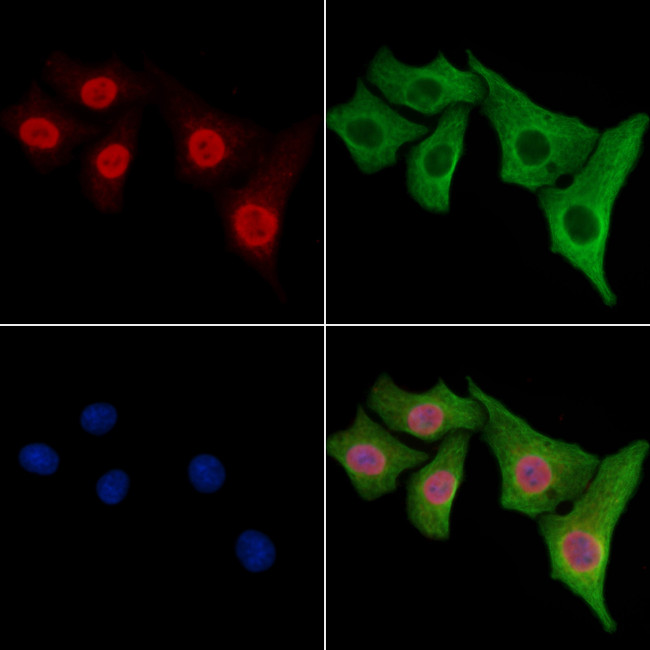 FUS Antibody in Immunocytochemistry (ICC/IF)