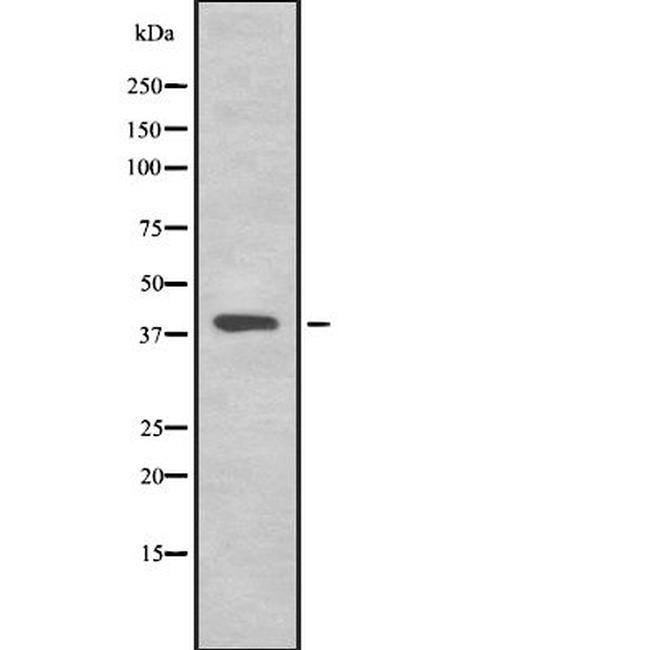 TMEFF2 Antibody in Western Blot (WB)