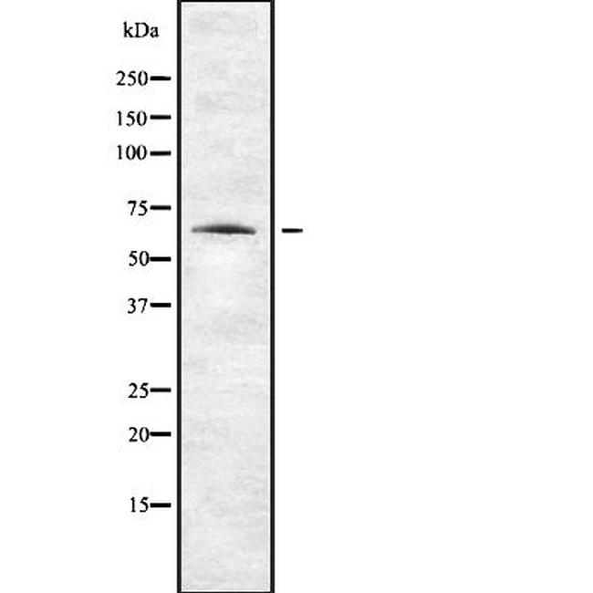 ENC1 Antibody in Western Blot (WB)