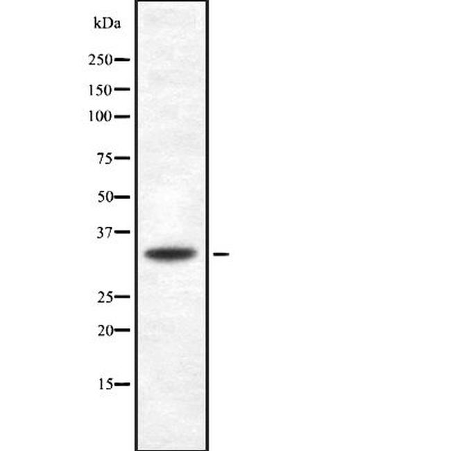 CD275 (B7-H2) Antibody in Western Blot (WB)