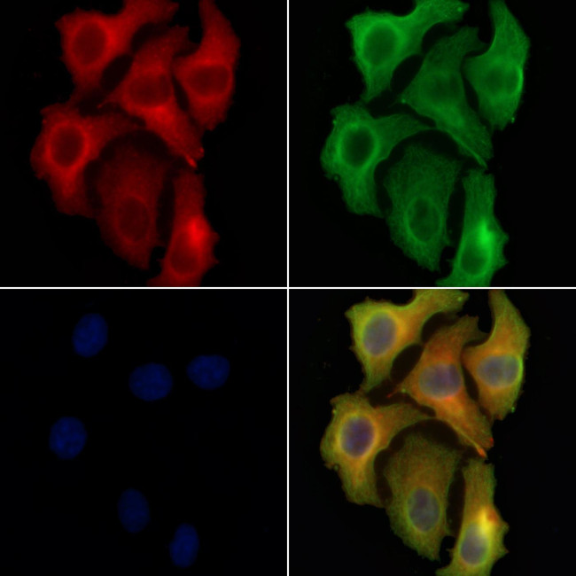 LIPF Antibody in Immunocytochemistry (ICC/IF)