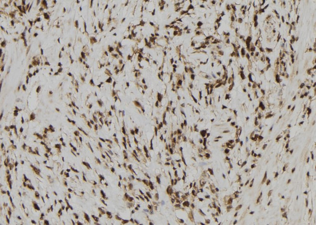 RAE1 Antibody in Immunohistochemistry (Paraffin) (IHC (P))