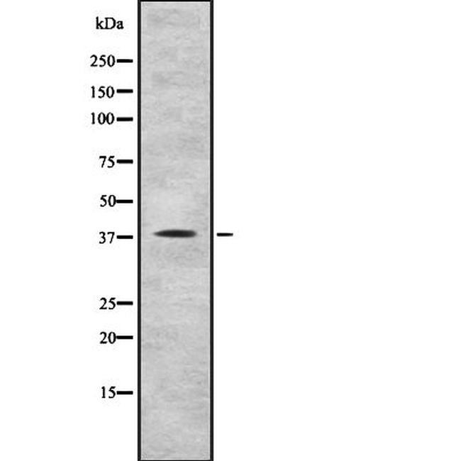 RAE1 Antibody in Western Blot (WB)