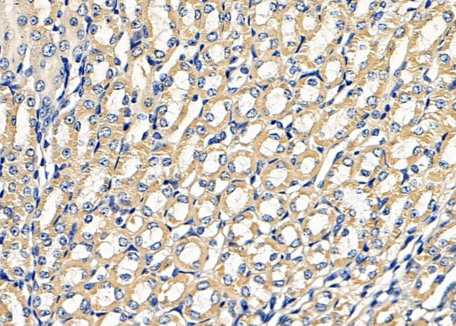 ARF5 Antibody in Immunohistochemistry (Paraffin) (IHC (P))