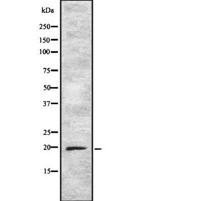 ARF5 Antibody in Western Blot (WB)