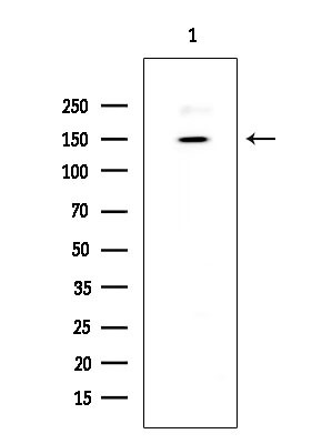 BRCAA1 Antibody in Western Blot (WB)