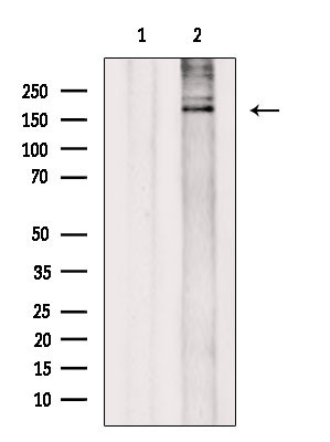 SMARCA2 Antibody in Western Blot (WB)