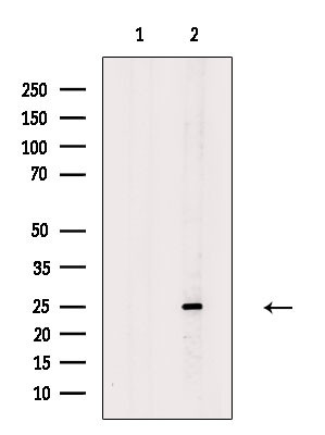 Cathepsin H Antibody in Western Blot (WB)