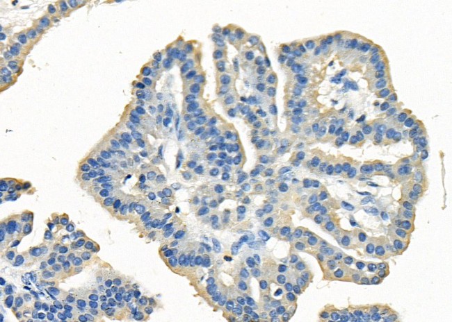 CD42b Antibody in Immunohistochemistry (Paraffin) (IHC (P))