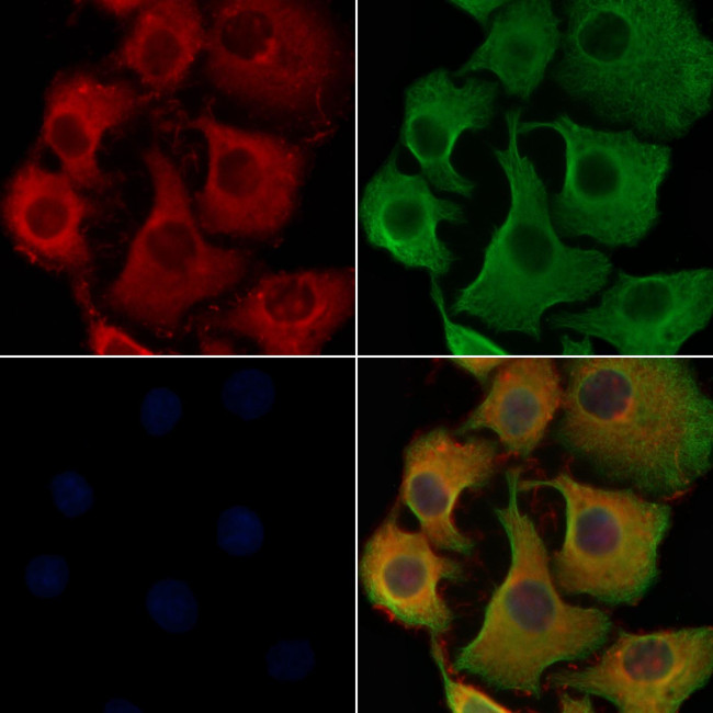 COLQ Antibody in Immunocytochemistry (ICC/IF)