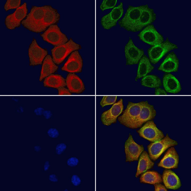 ELMO1 Antibody in Immunocytochemistry (ICC/IF)