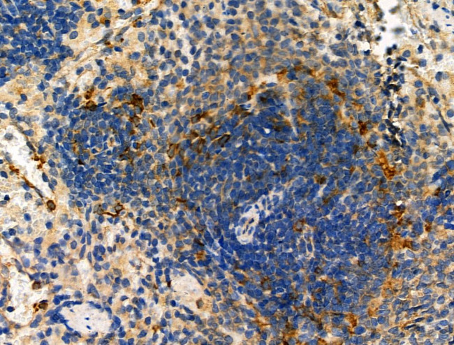 ELMO1 Antibody in Immunohistochemistry (Paraffin) (IHC (P))