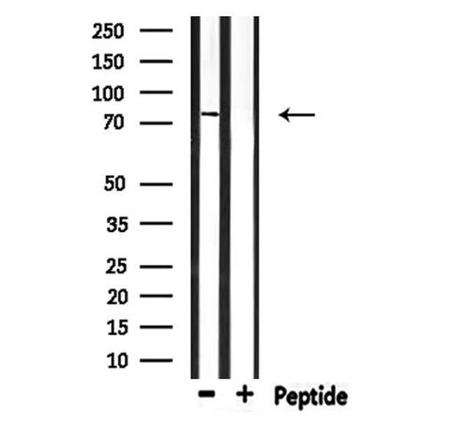 ELMO1 Antibody in Western Blot (WB)