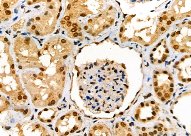 SCNN1G Antibody in Immunohistochemistry (Paraffin) (IHC (P))