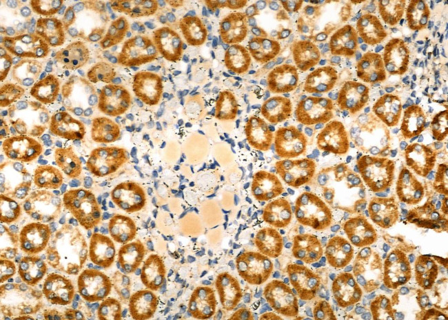 SCNN1G Antibody in Immunohistochemistry (Paraffin) (IHC (P))