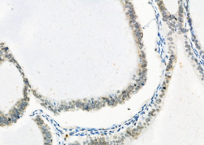 Erbin Antibody in Immunohistochemistry (Paraffin) (IHC (P))