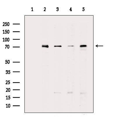 GCLC Antibody in Western Blot (WB)