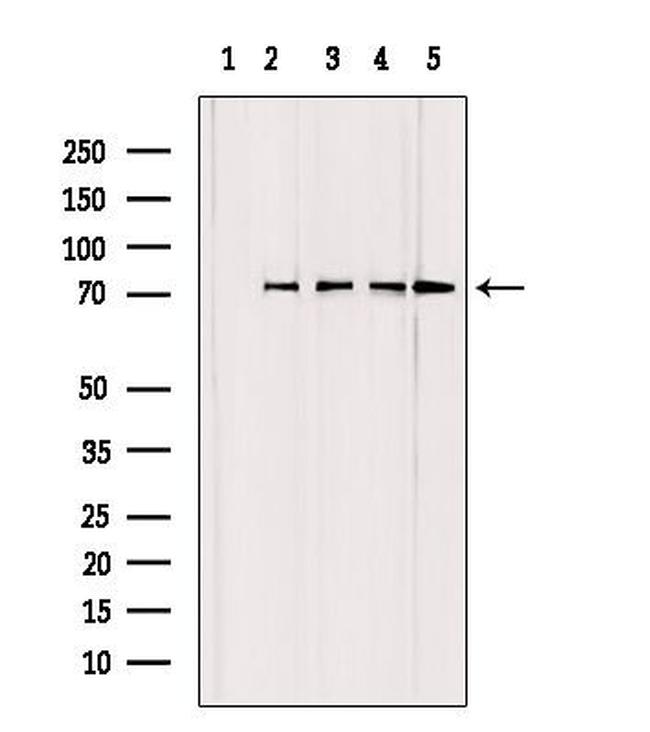 GCLC Antibody in Western Blot (WB)