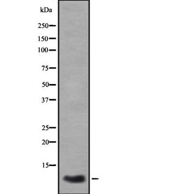 CXCL3 Antibody in Western Blot (WB)