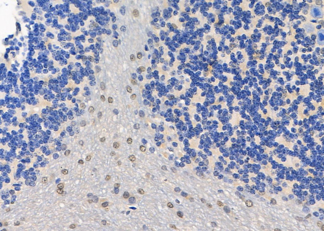 HIC2 Antibody in Immunohistochemistry (Paraffin) (IHC (P))