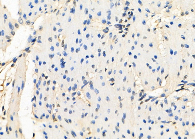 HIC2 Antibody in Immunohistochemistry (Paraffin) (IHC (P))