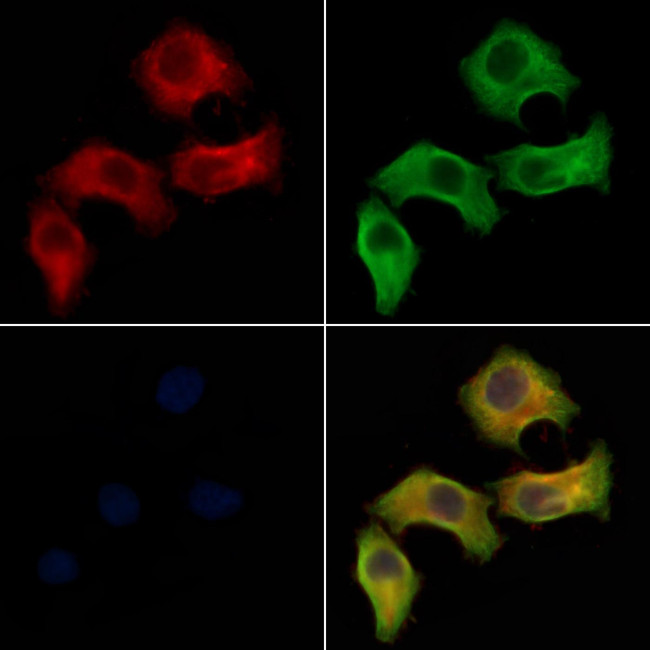 IL20RA Antibody in Immunocytochemistry (ICC/IF)