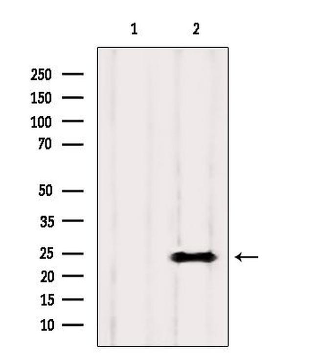 KCNMB4 Antibody in Western Blot (WB)