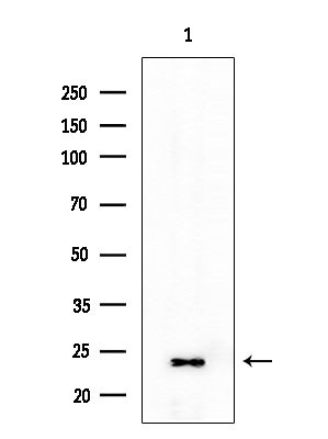 TSPAN9 Antibody in Western Blot (WB)