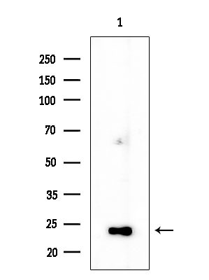 TSPAN9 Antibody in Western Blot (WB)