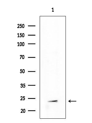 TSPAN9 Antibody in Western Blot (WB)