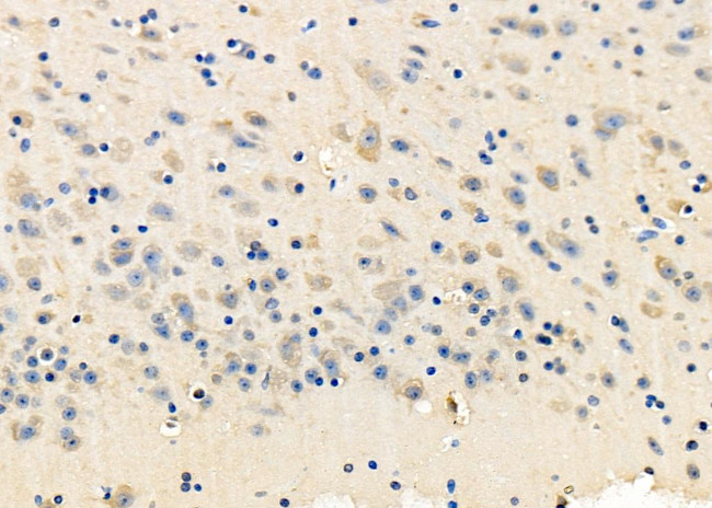 NMDAR2C Antibody in Immunohistochemistry (Paraffin) (IHC (P))