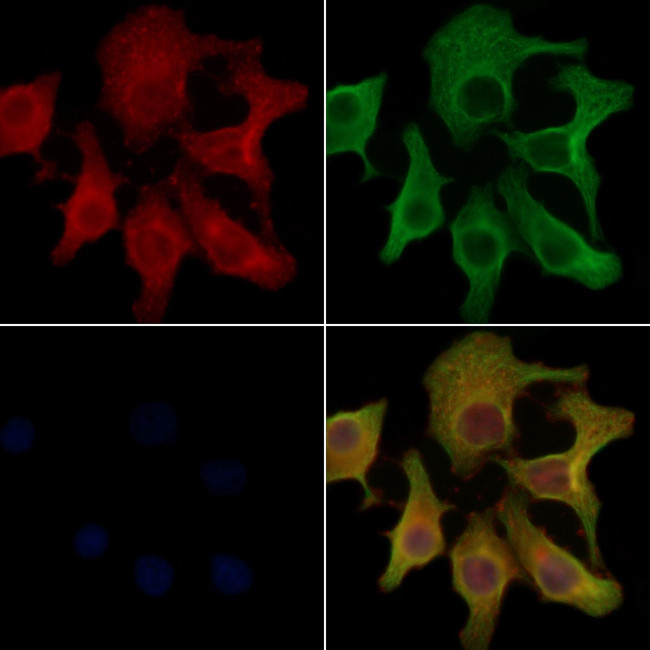 PANK2 Antibody in Immunocytochemistry (ICC/IF)