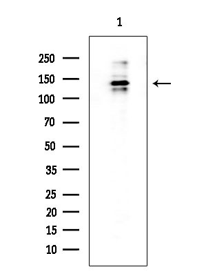 Drosha Antibody in Western Blot (WB)