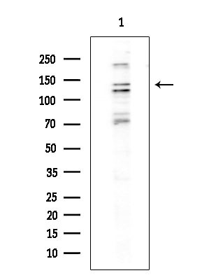 Drosha Antibody in Western Blot (WB)