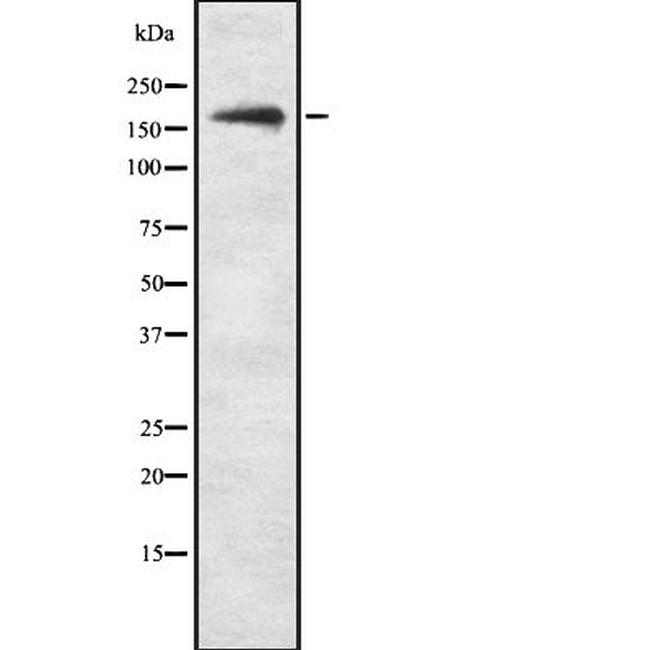 PHLPP1 Antibody in Western Blot (WB)