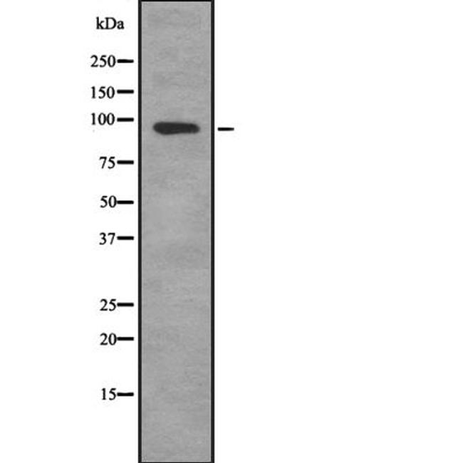 SEMA4C Antibody in Western Blot (WB)