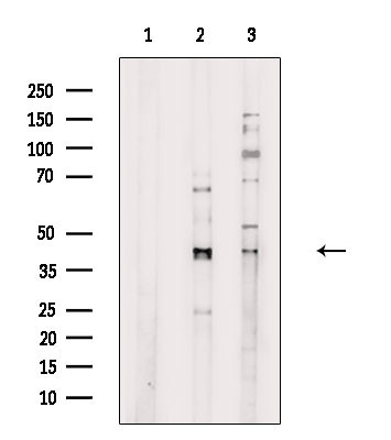 KCNK3 Antibody in Western Blot (WB)
