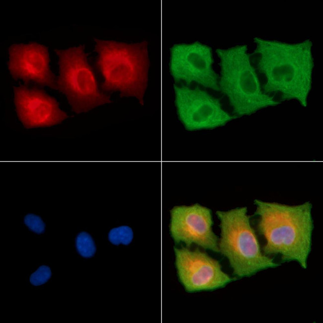 TENC1 Antibody in Immunocytochemistry (ICC/IF)