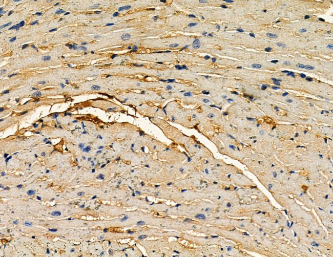 TENC1 Antibody in Immunohistochemistry (Paraffin) (IHC (P))