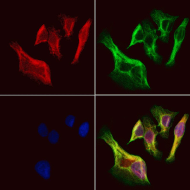 UCP2 Antibody in Immunocytochemistry (ICC/IF)