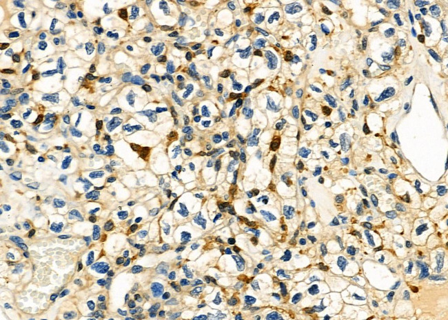 UCP2 Antibody in Immunohistochemistry (Paraffin) (IHC (P))