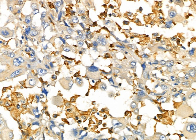 UCP2 Antibody in Immunohistochemistry (Paraffin) (IHC (P))