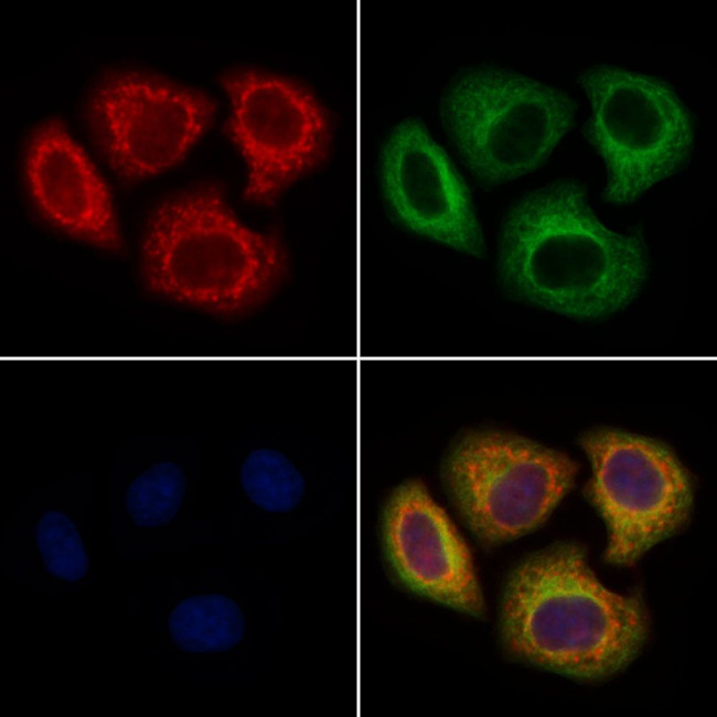 UGT8 Antibody in Immunocytochemistry (ICC/IF)