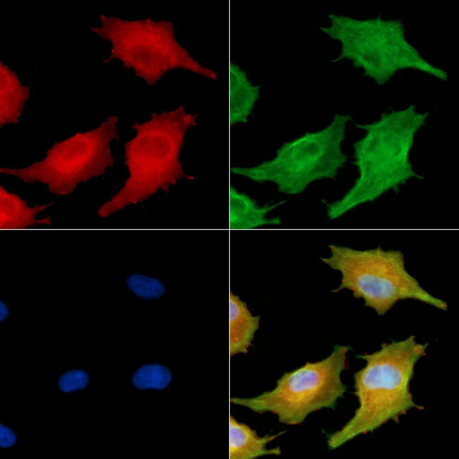 VAMP1/VAMP2/VAMP3 Antibody in Immunocytochemistry (ICC/IF)