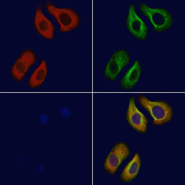 ADORA2B Antibody in Immunocytochemistry (ICC/IF)