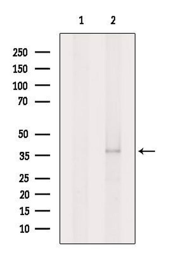 ADORA2B Antibody in Western Blot (WB)