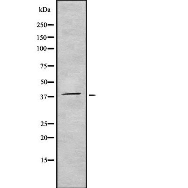 Aurora B/C Antibody in Western Blot (WB)