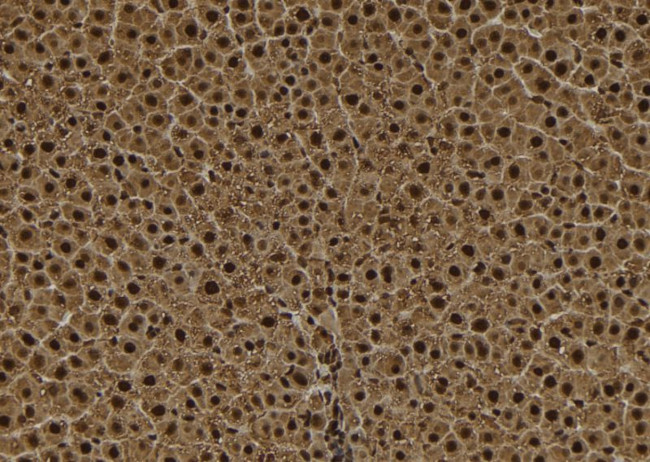 TPX2 Antibody in Immunohistochemistry (Paraffin) (IHC (P))